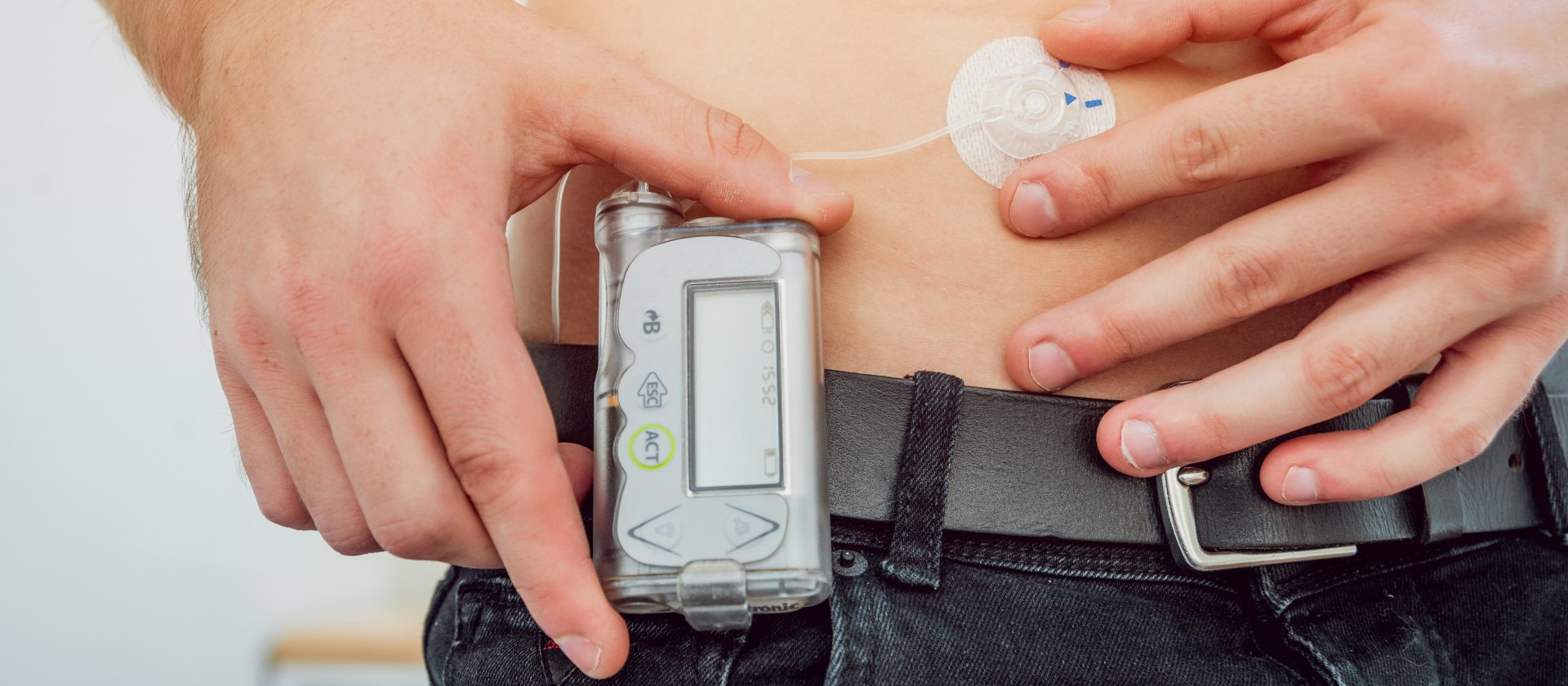 man with glucose monitor