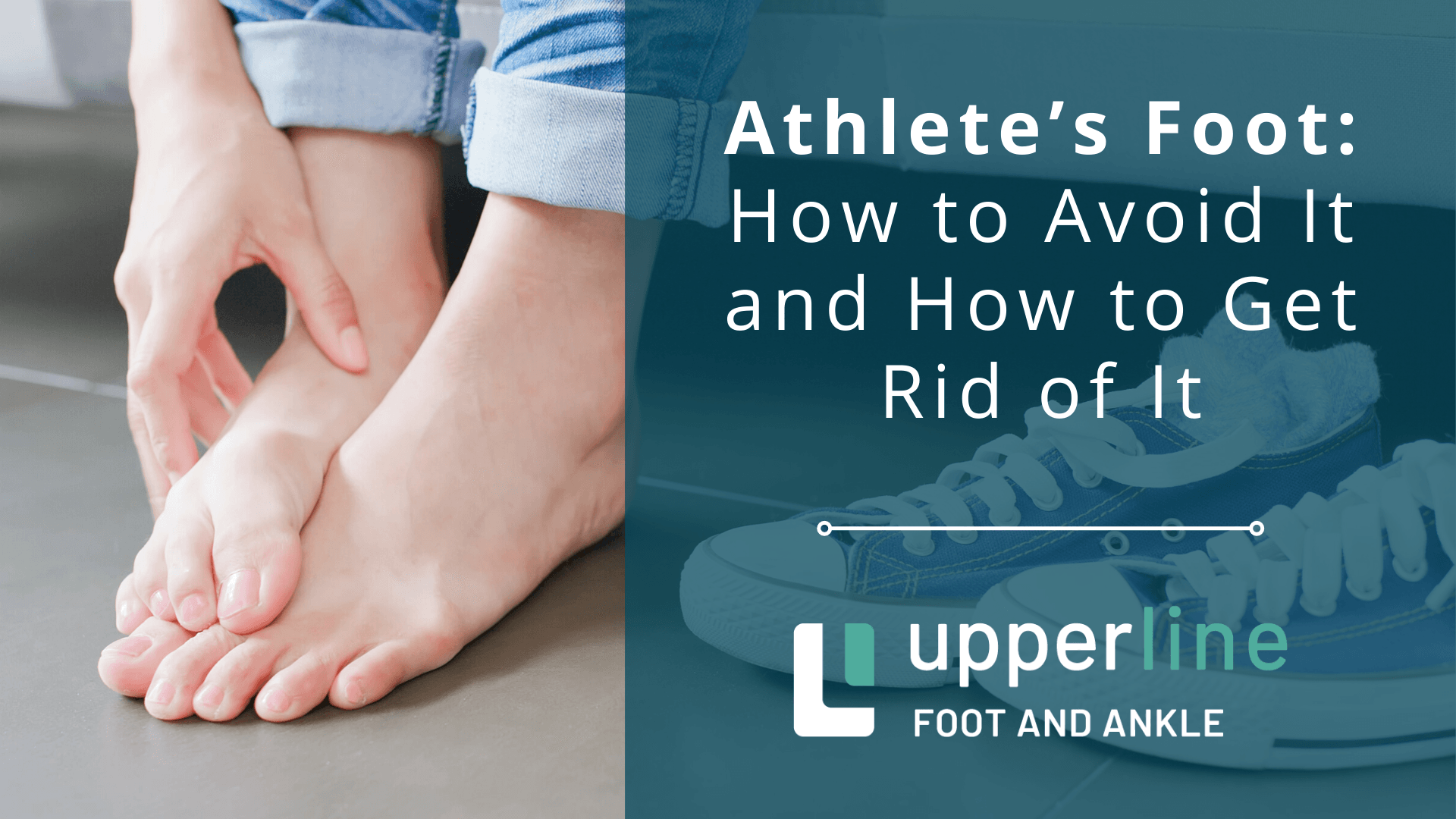 How to avoid athlete's foot