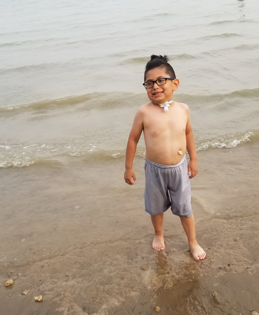 Child with tracheostomy tube and feeding tube at the beach