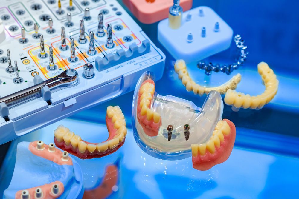 A Tray Of Dental Implants And Dentures On A Table — Dentures Direct Taree-Rod Hinton In Taree, NSW