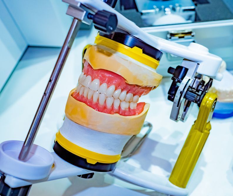 A Model Of A Person 's Teeth Is Sitting On A Table — Dentures Direct Taree-Rod Hinton In Port Macquarie, NSW
