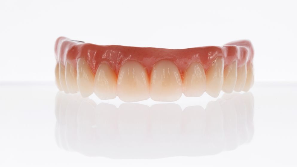 A Close Up Of A Denture On A Model Of A Person 's Teeth — Dentures Direct Taree-Rod Hinton In Wauchope, NSW