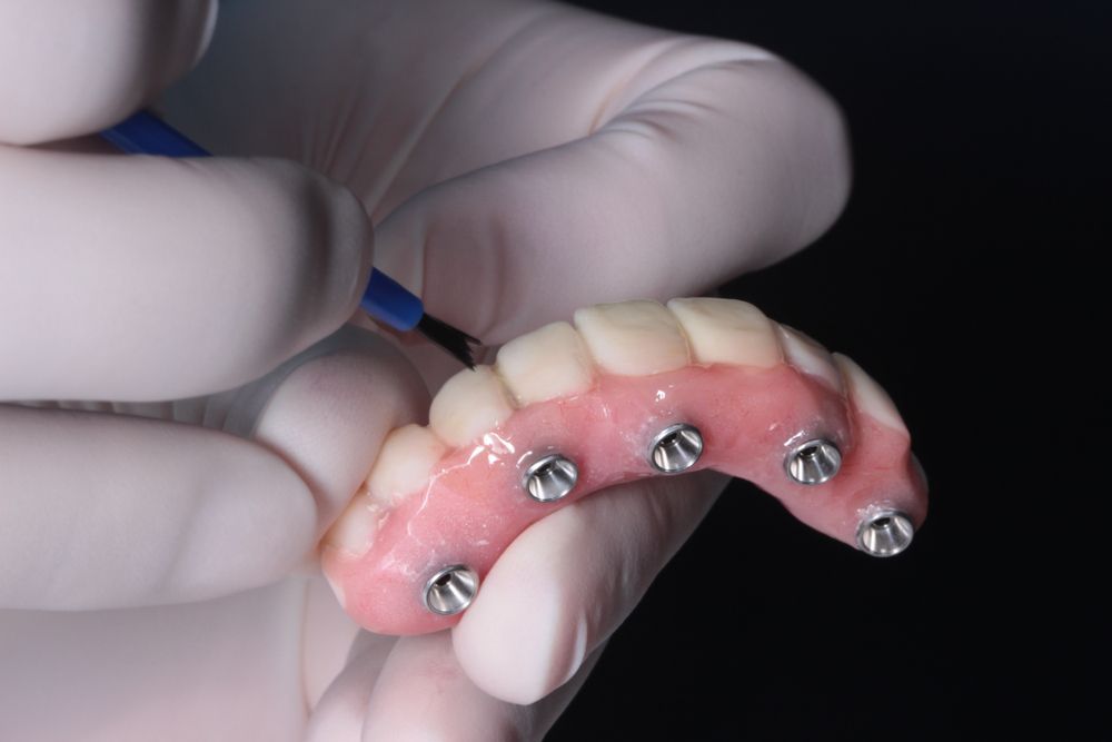 A Person Is Holding A Denture With Screws On It — Dentures Direct Taree-Rod Hinton In Port Macquarie, NSW