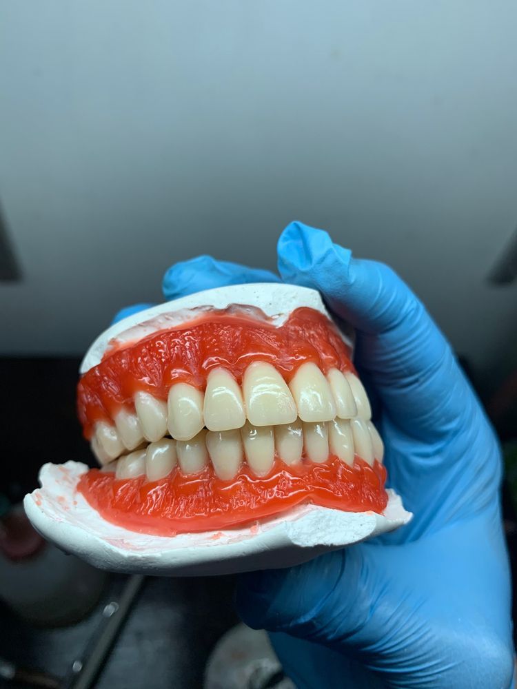A Person Wearing Blue Gloves Is Holding A Model Of Teeth — Dentures Direct Taree-Rod Hinton In Taree, NSW