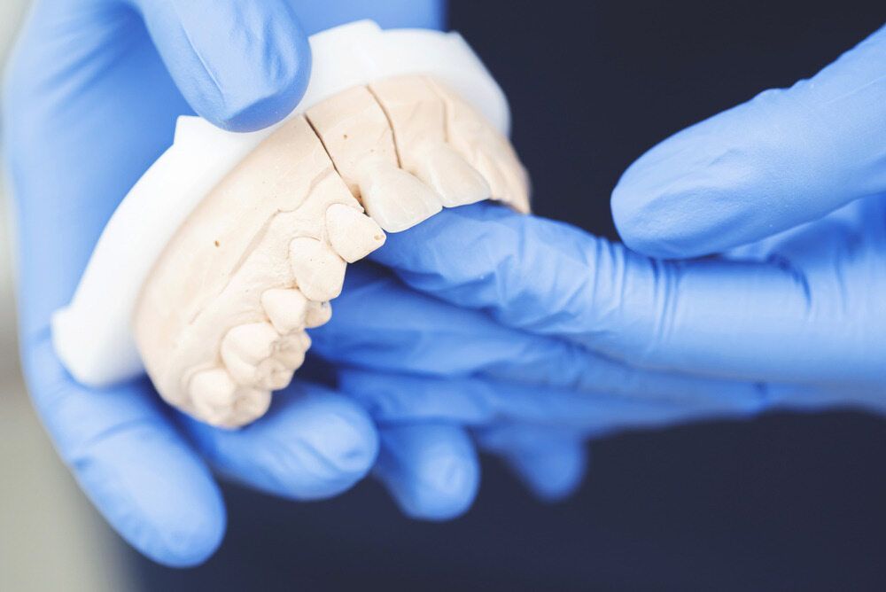 A Person Wearing Blue Gloves Is Holding A Model Of Teeth — Dentures Direct Taree-Rod Hinton In Laurieton, NSW