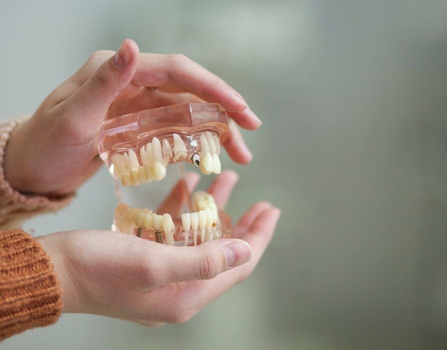 A Person Is Holding A Model Of Teeth In Their Hands — Dentures Direct Taree-Rod Hinton In Taree, NSW