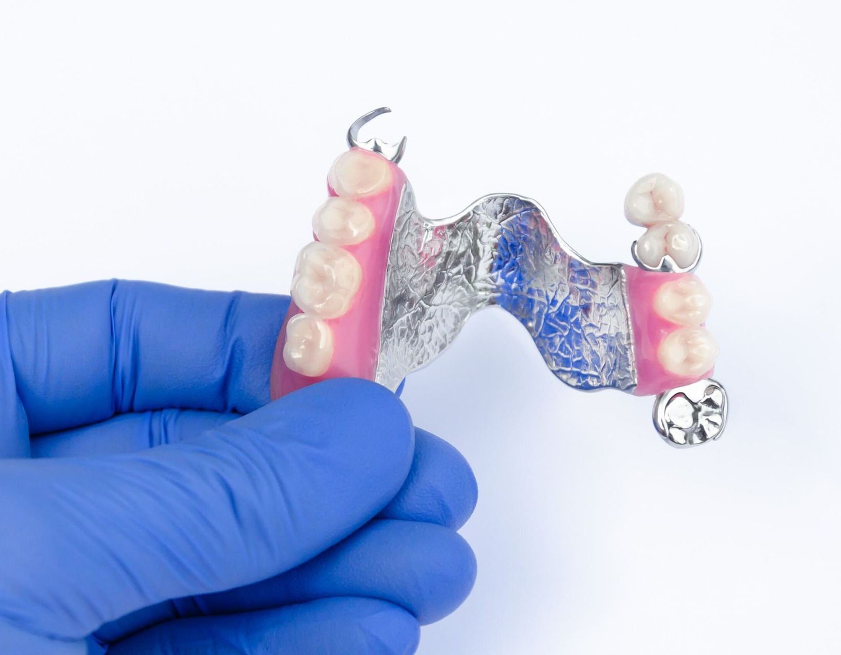A person wearing blue gloves is holding a dental prosthetic in their hand — Dentures Direct Taree-Rod Hinton In Taree, NSW