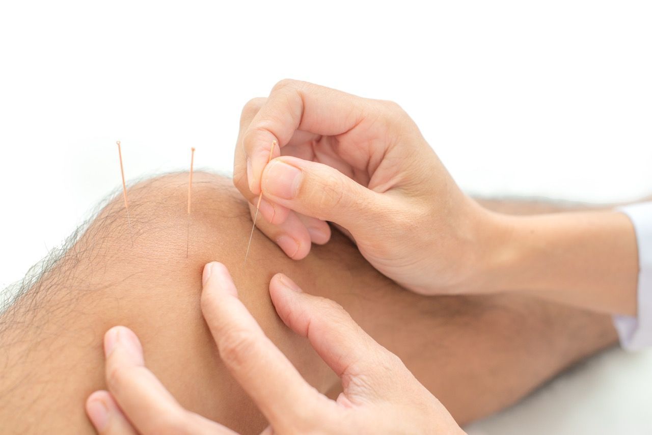 Closeup of hand performing acupuncture therapy a man's knee