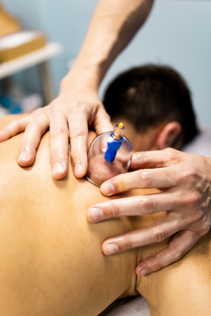 Myofascial cupping on patient back