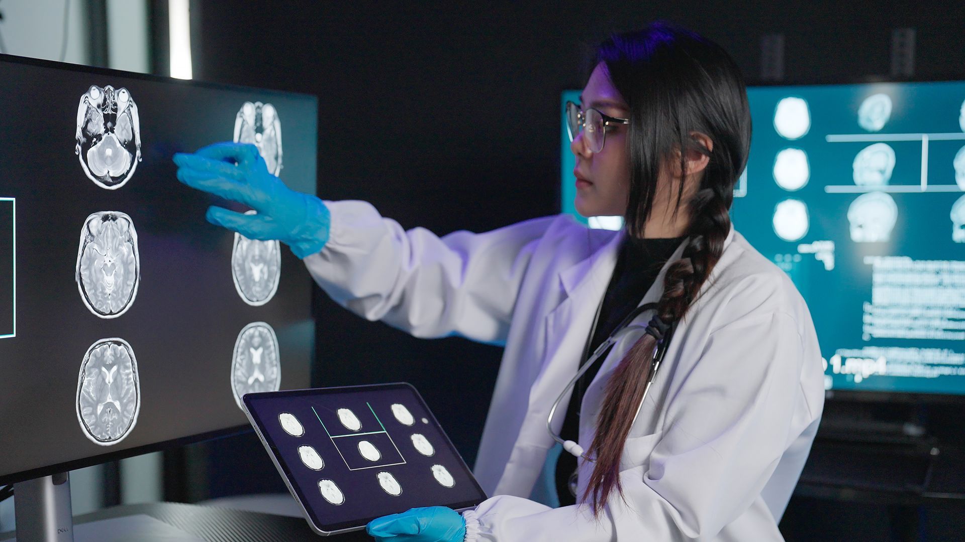 A female doctor, wearing a lab coat, checks the images of a cranial MRI, inside a lab room.