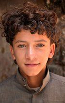 Juvenile Angiofibroma