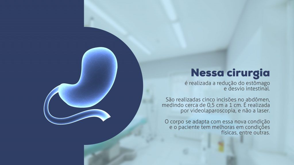 Dúvidas sobre Cirurgia Bariátrica Videolaparoscópica Técnica Bypass G J