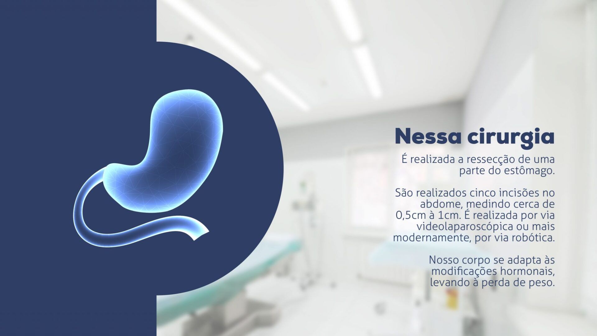 Dúvidas sobre Cirurgia Bariátrica Videolaparoscópica Técnica Sleeve Gastrectomy