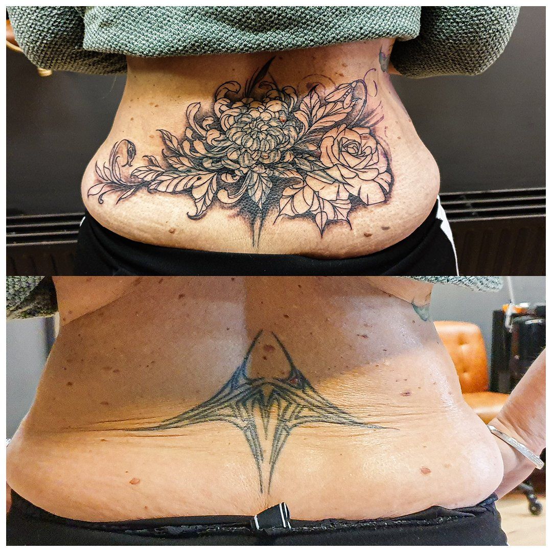 Een vrouw heeft een tatoeage op haar rug die is verwijderd.