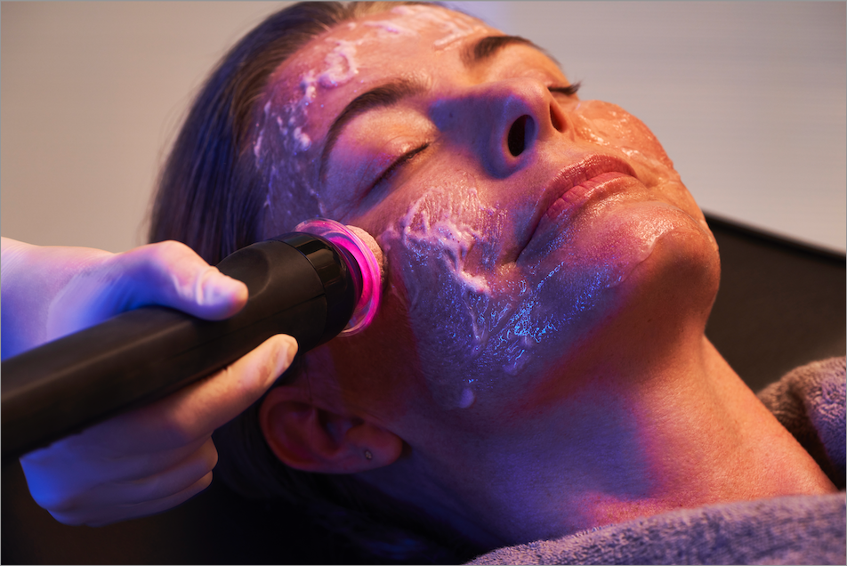 Laser Facelifting Procedure — Saint Johns, FL — Live Without Lines Med Spa 