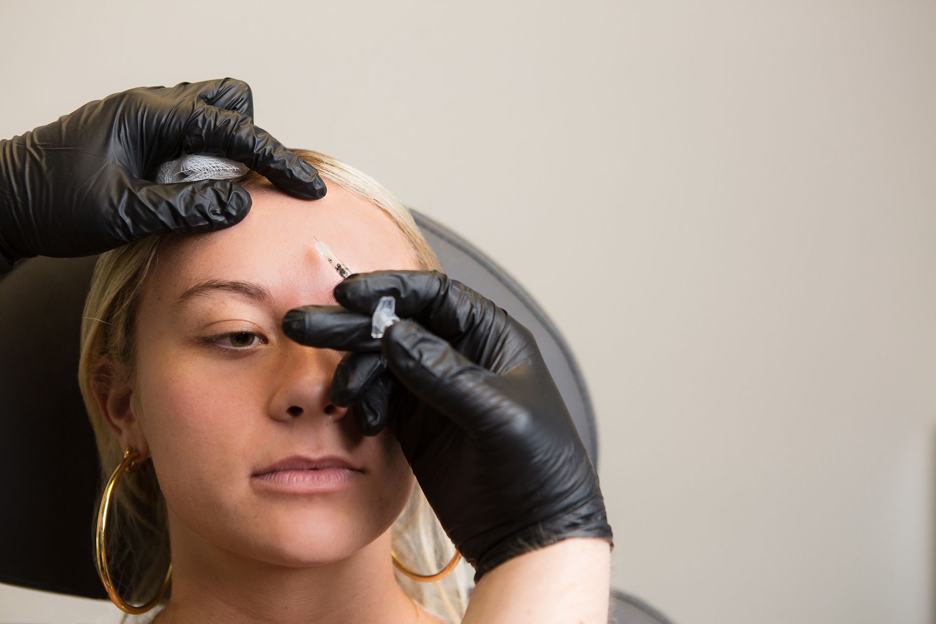 Beauty treatment with Botox — Saint Johns, FL — Live Without Lines Med Spa 