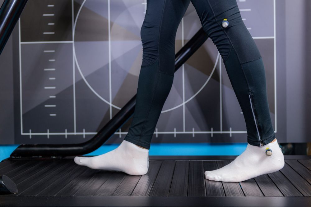 A Person Wearing White Socks Is Walking On A Treadmill — Mooloolaba Foot Centre In Mooloolaba, QLD