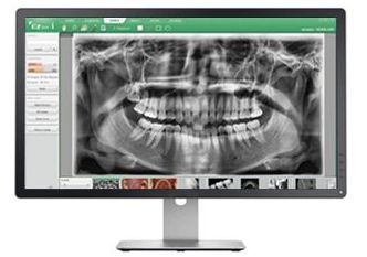3d scan of mouth