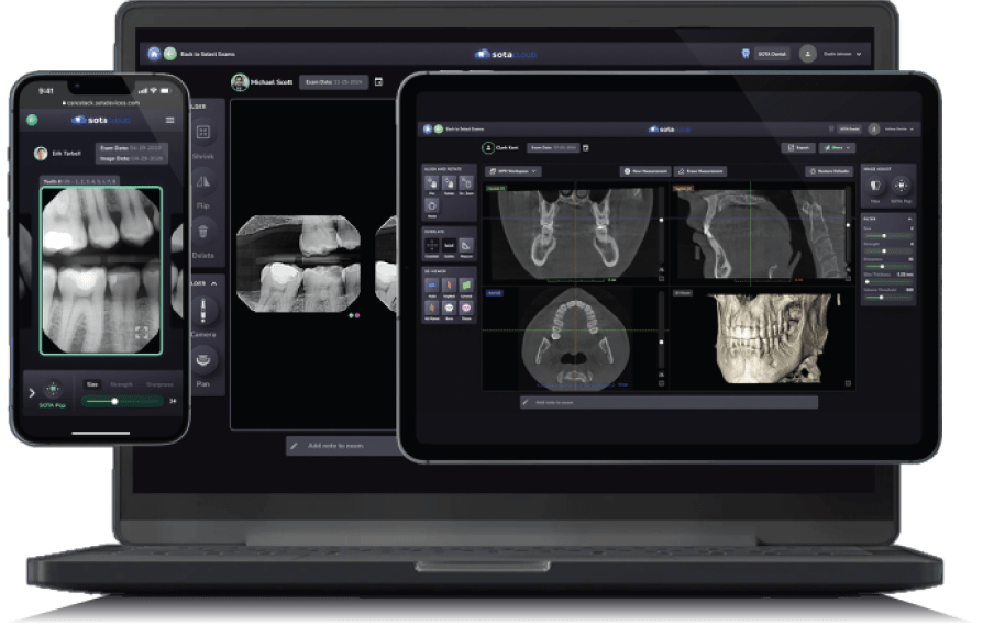 Moutwatch box with camera