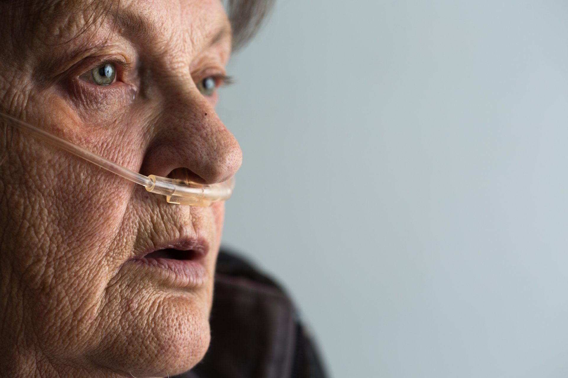 An elderly woman is wearing an oxygen tube in her nose.
