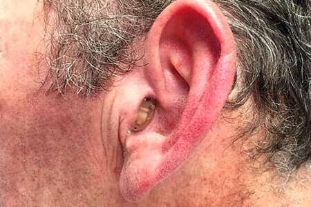 New Hearing Aid — Left Ear with Hearing Aid in Bend, OR