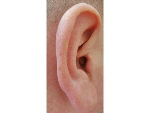 Custom Hearing Aid — Wearing an In-Canal Hearing Aid — Bend, OR
