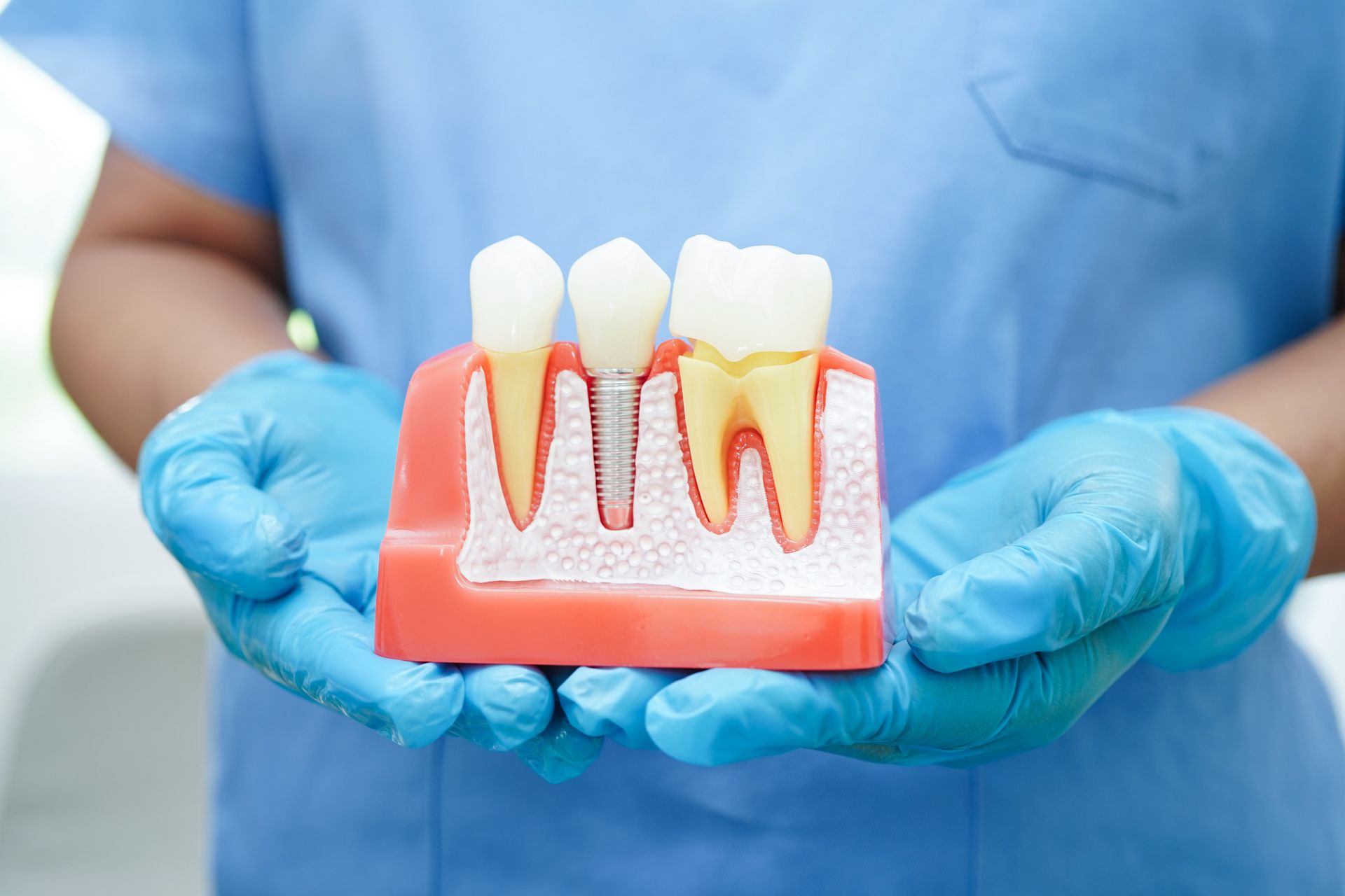 Doctor wearing protective gloves holding dental implant model at Calm Waters Dentistry, for dental i