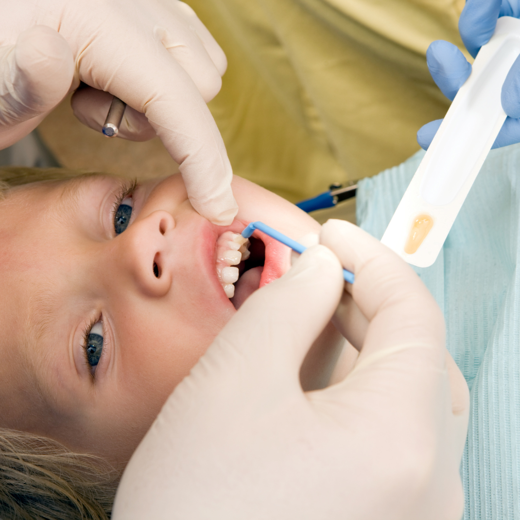 Dr Mensah applying pediatric fluoride treatment during appointment in Tarrytown NY