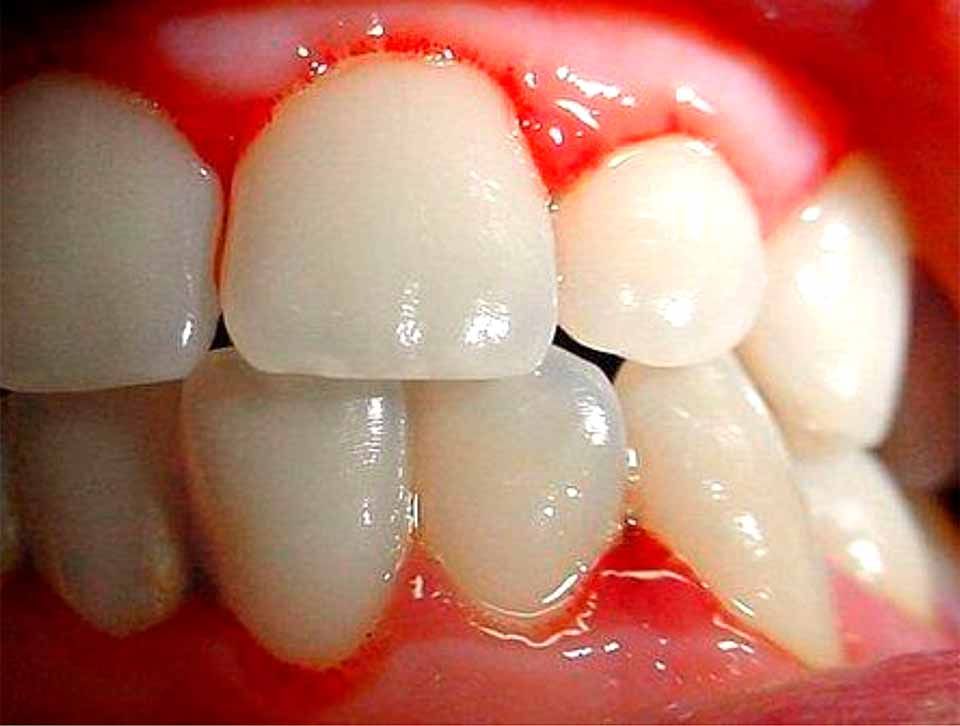 CLÍNICA DE PERIODONCIA 
