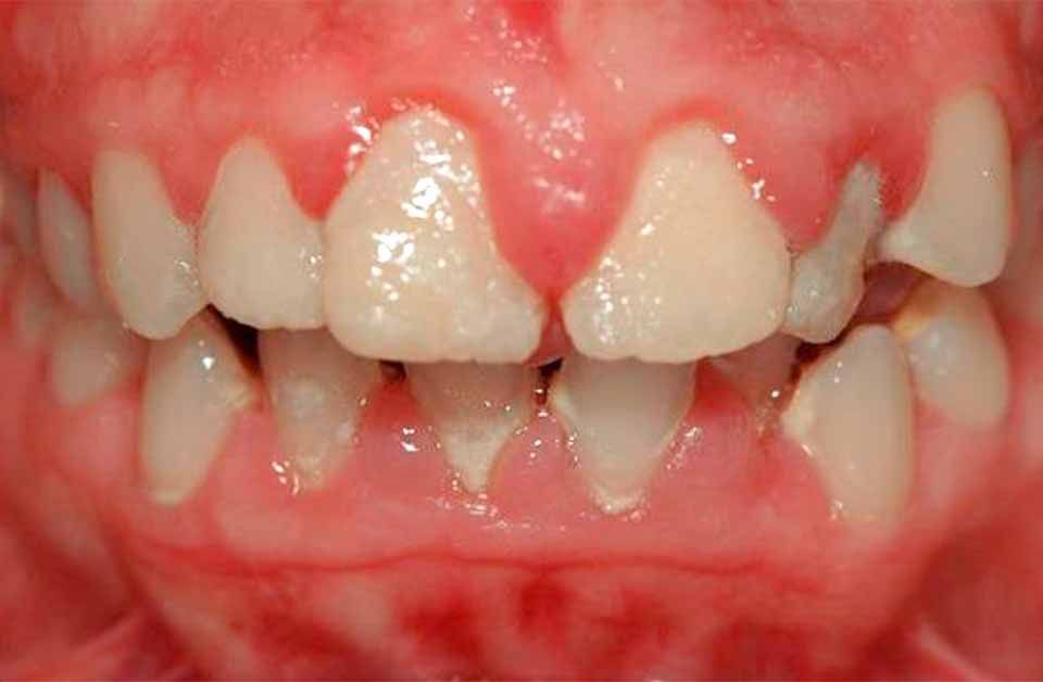 CLÍNICA DE PERIODONCIA 