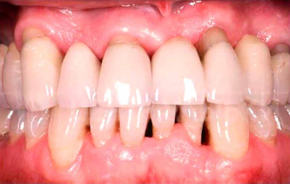 CLÍNICA DE PERIODONCIA 
