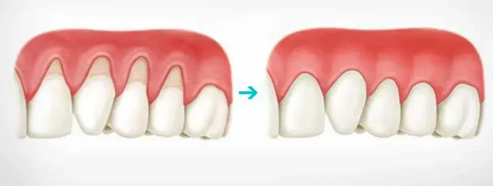 CLÍNICA DE PERIODONCIA 