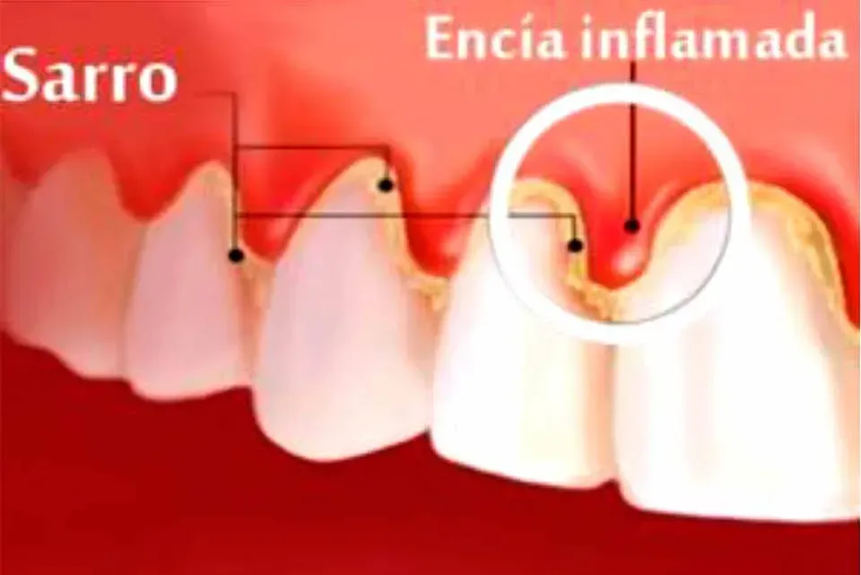 CLÍNICA DE PERIODONCIA 
