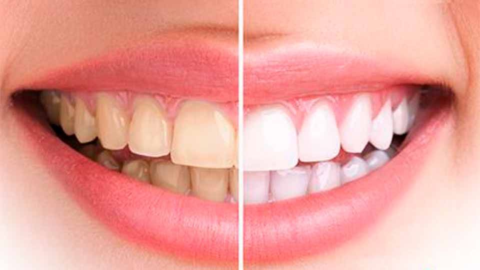 CLÍNICA DE PERIODONCIA 