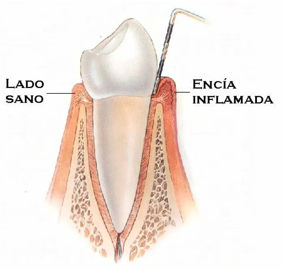 CLÍNICA DE PERIODONCIA 