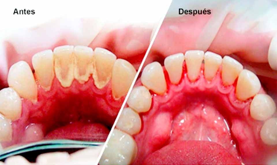 CLÍNICA DE PERIODONCIA 