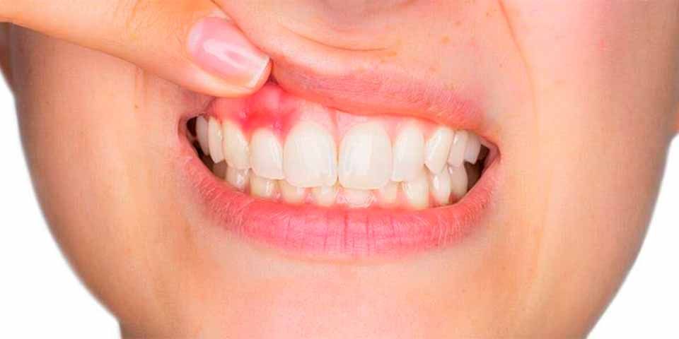 CLÍNICA DE PERIODONCIA 