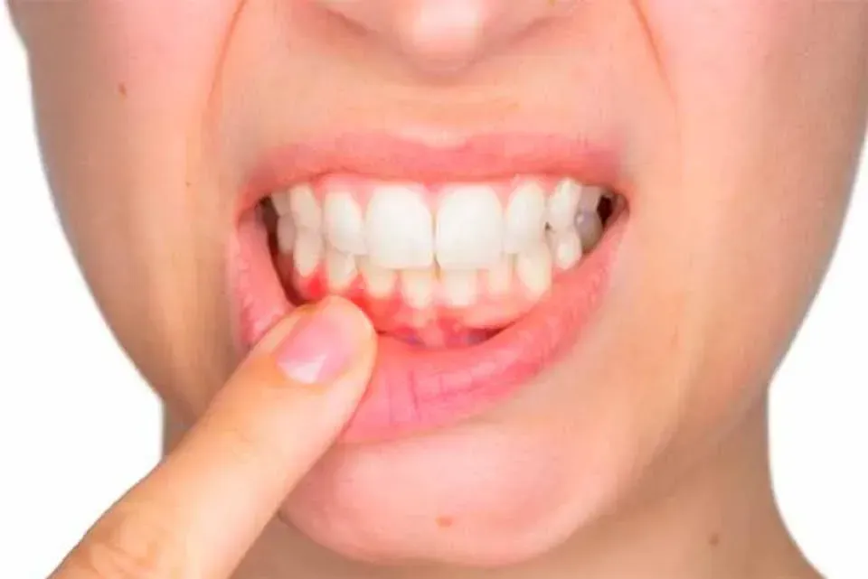 CLÍNICA DE PERIODONCIA 