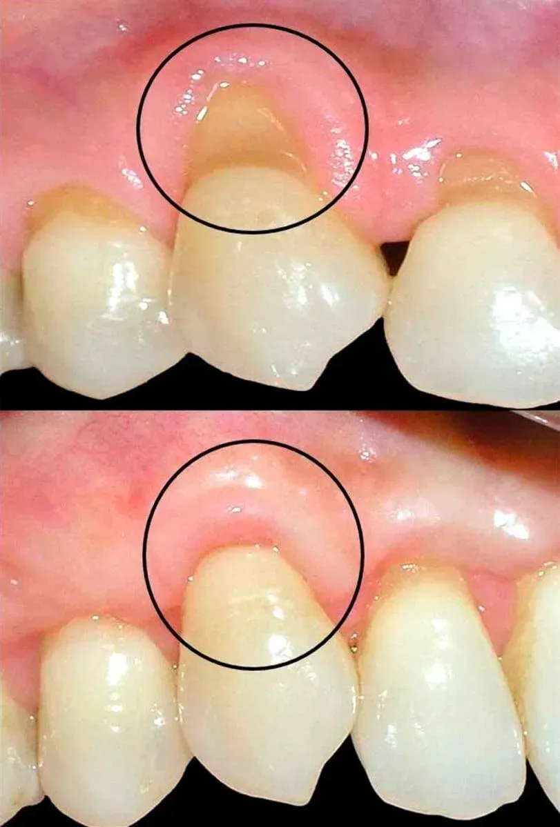 CLÍNICA DE PERIODONCIA 
