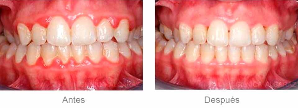 CLÍNICA DE PERIODONCIA 