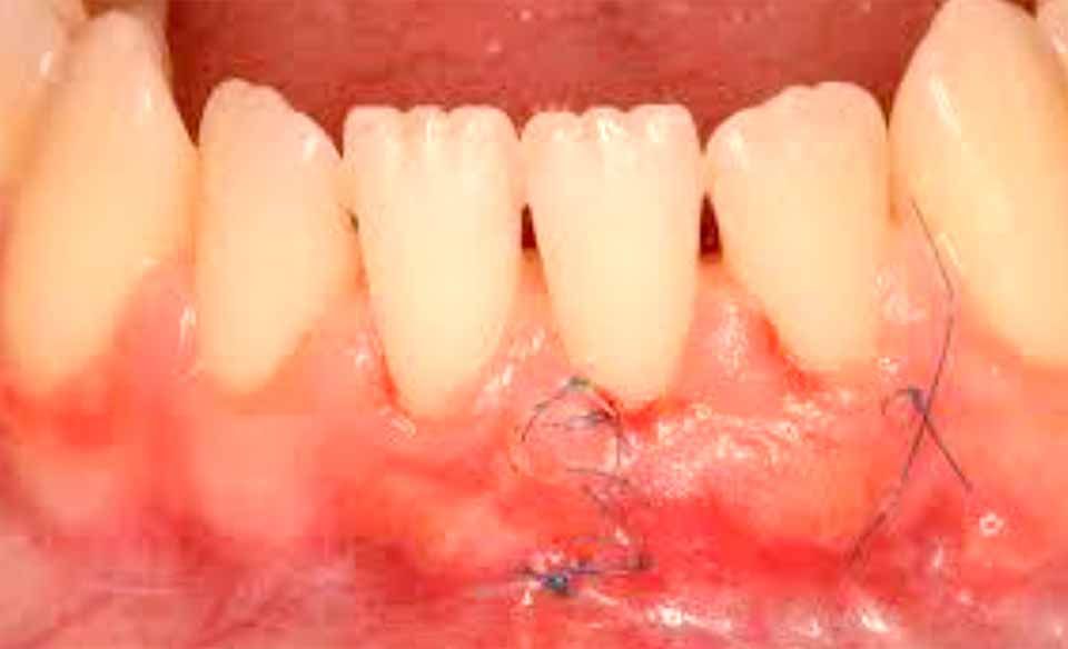 CLÍNICA DE PERIODONCIA 