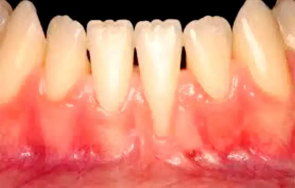 CLÍNICA DE PERIODONCIA 