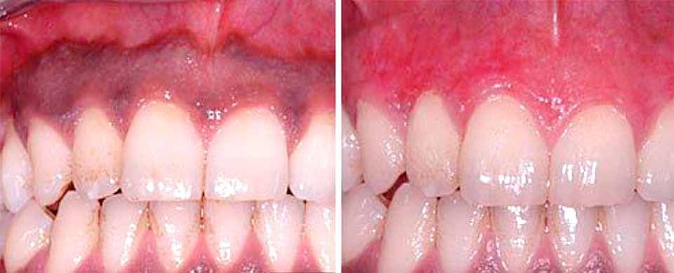 CLÍNICA DE PERIODONCIA 