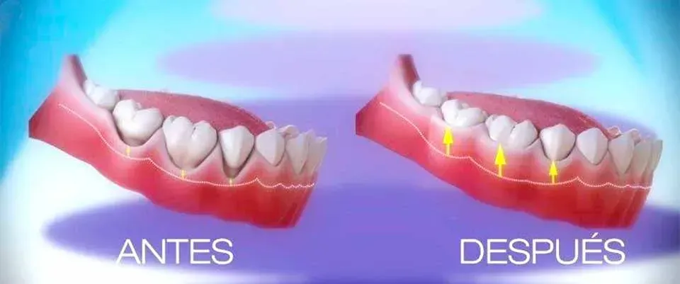CLÍNICA DE PERIODONCIA 