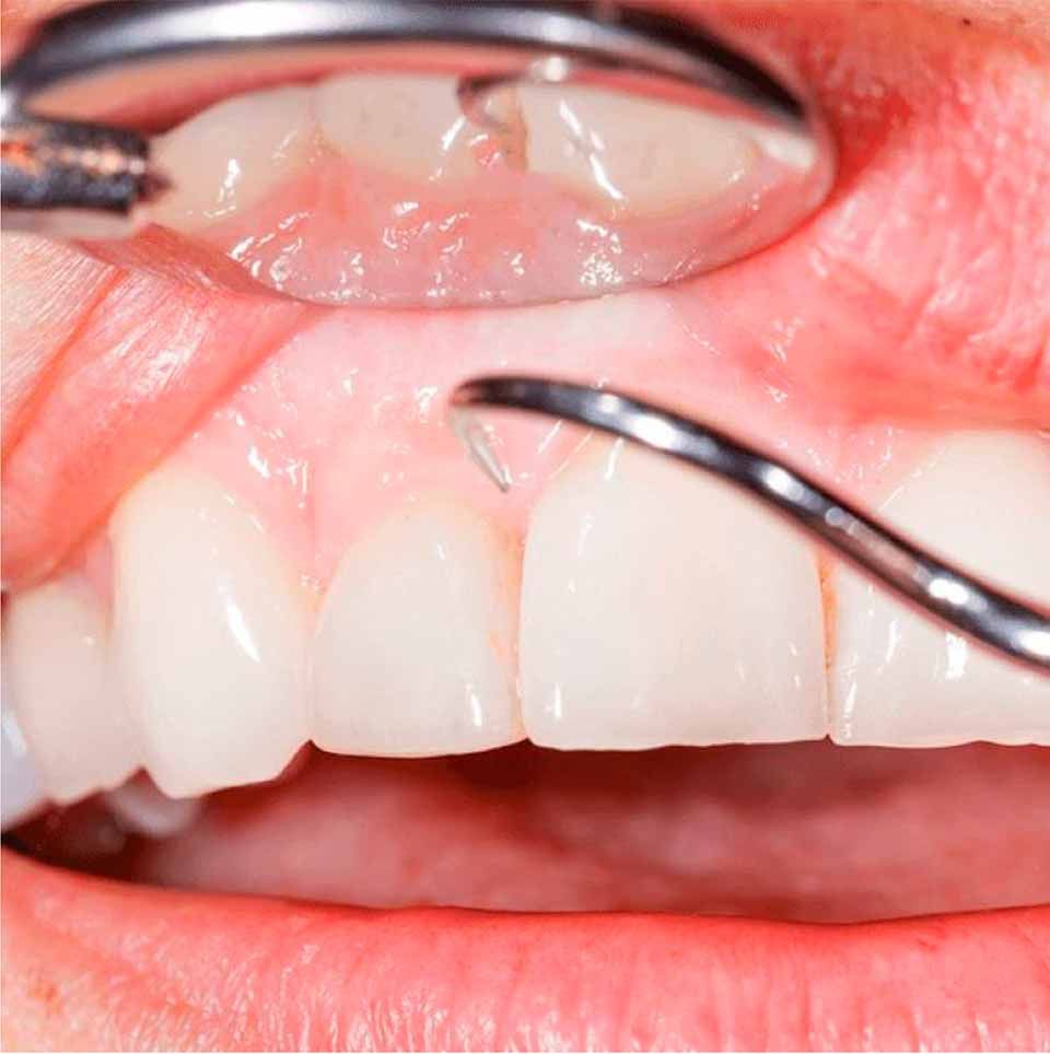 CLÍNICA DE PERIODONCIA 