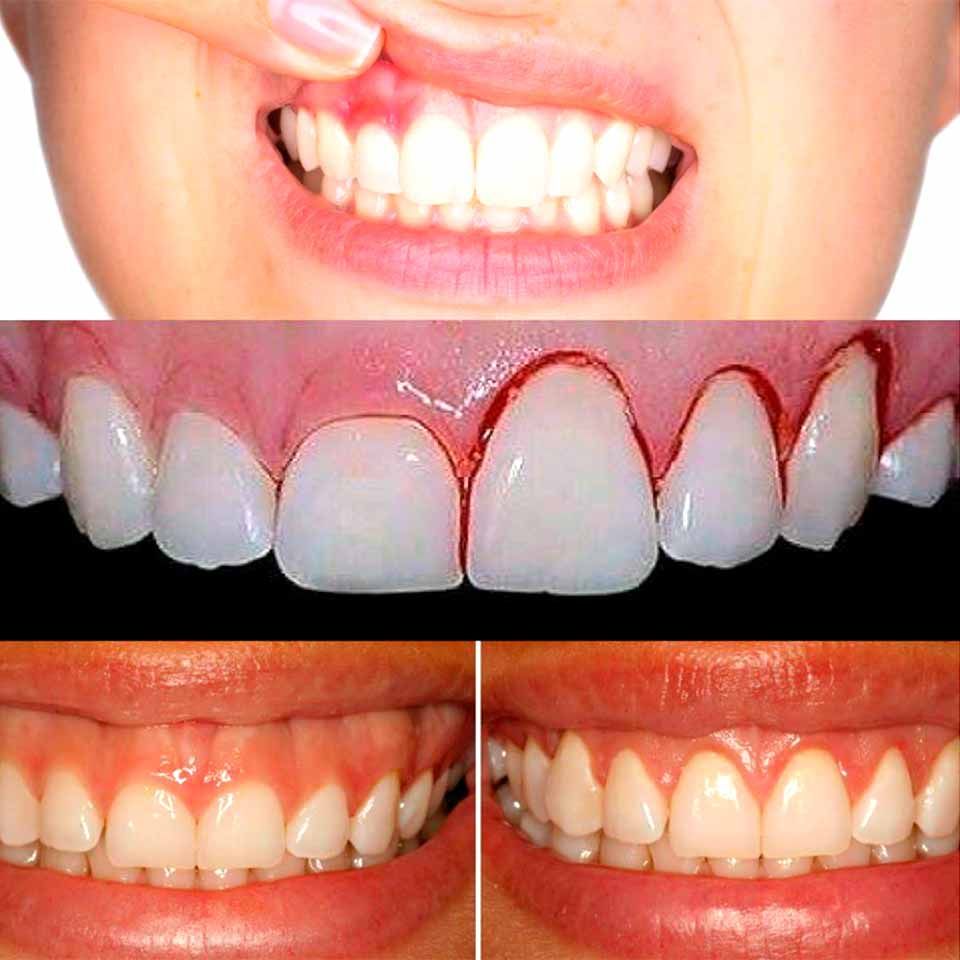 CLÍNICA DE PERIODONCIA 