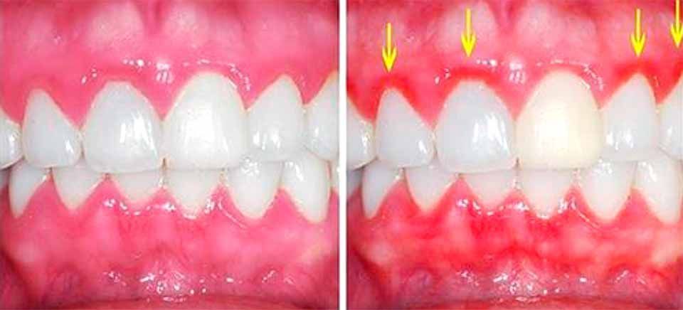 CLÍNICA DE PERIODONCIA 