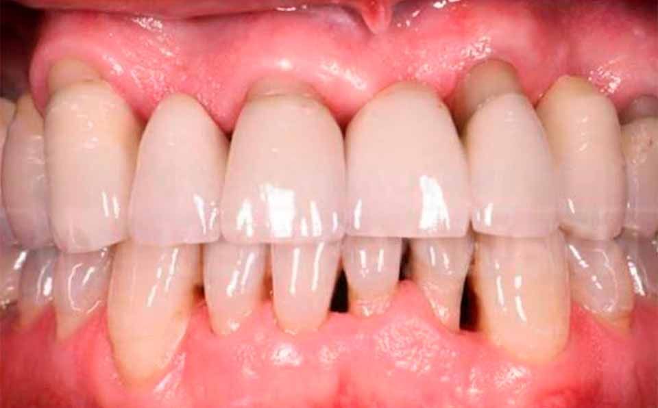 CLÍNICA DE PERIODONCIA 