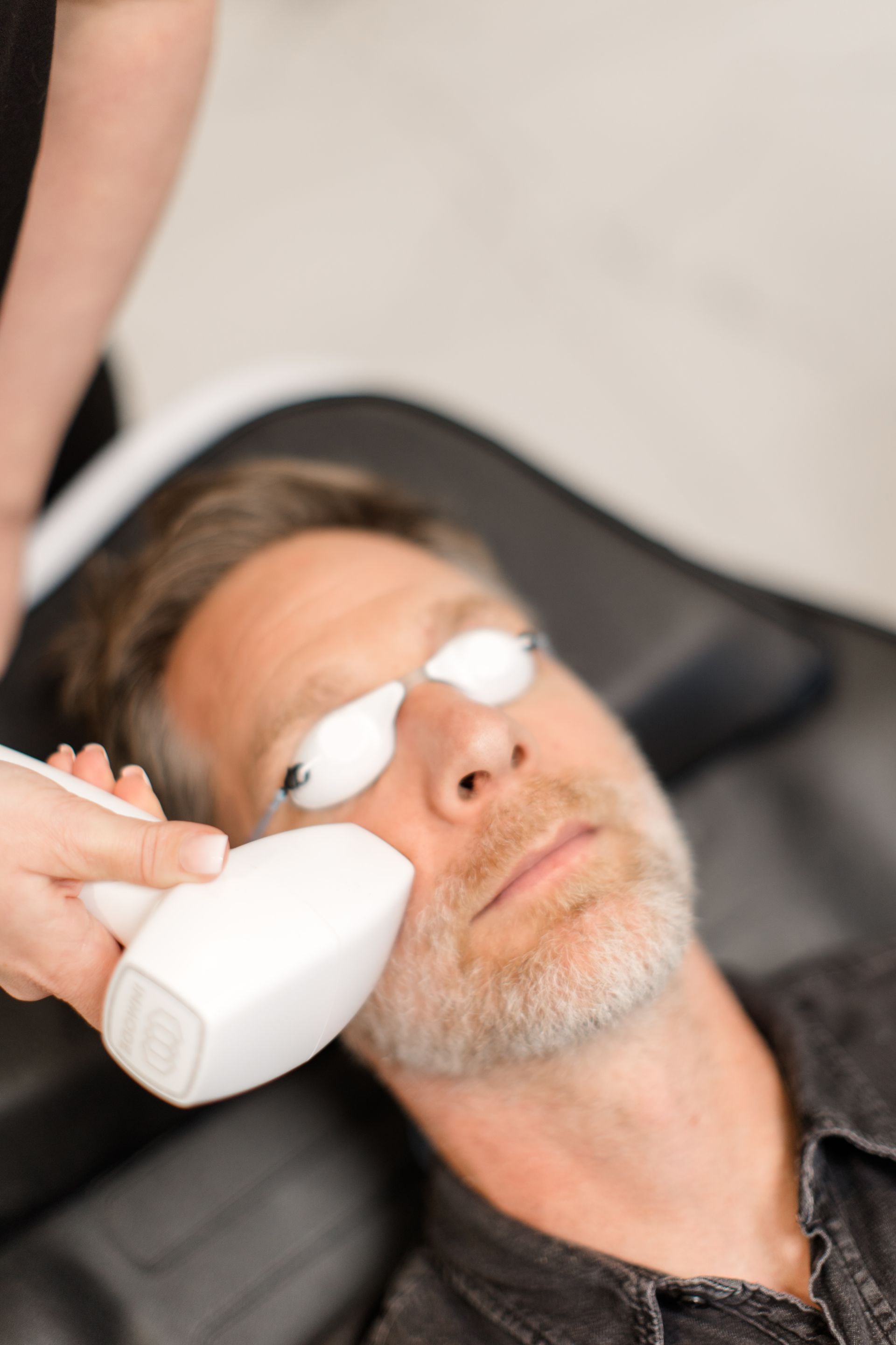A man with a beard is getting a laser treatment on his face.