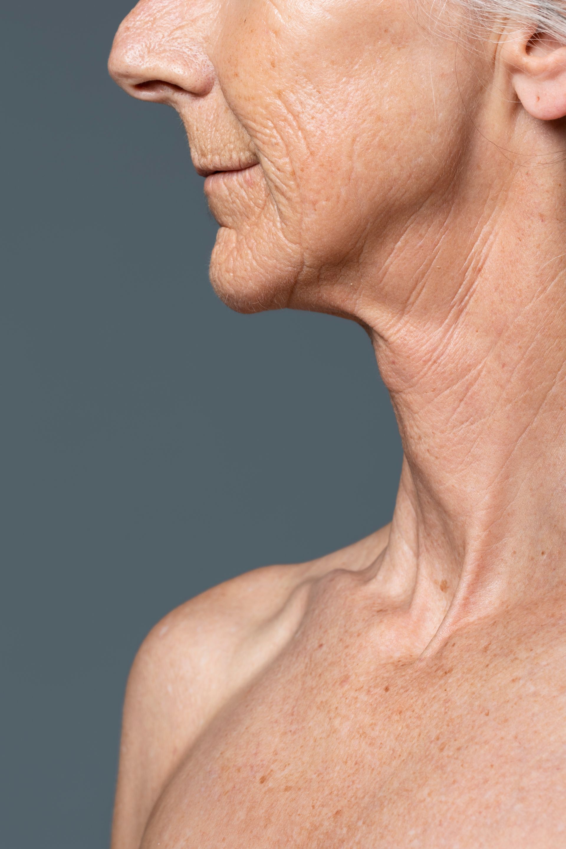 A close up of an older woman 's neck and face against a gray background.